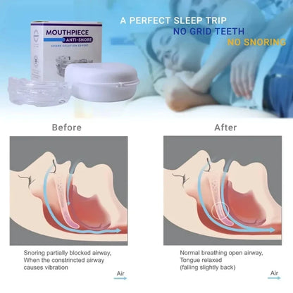 1/2/3/4/5 pieces, Anti-snoring Dent Guard for Bruxism, Improves Sleep, Bruxism, Apnea, and Snoring, Device for Snoring